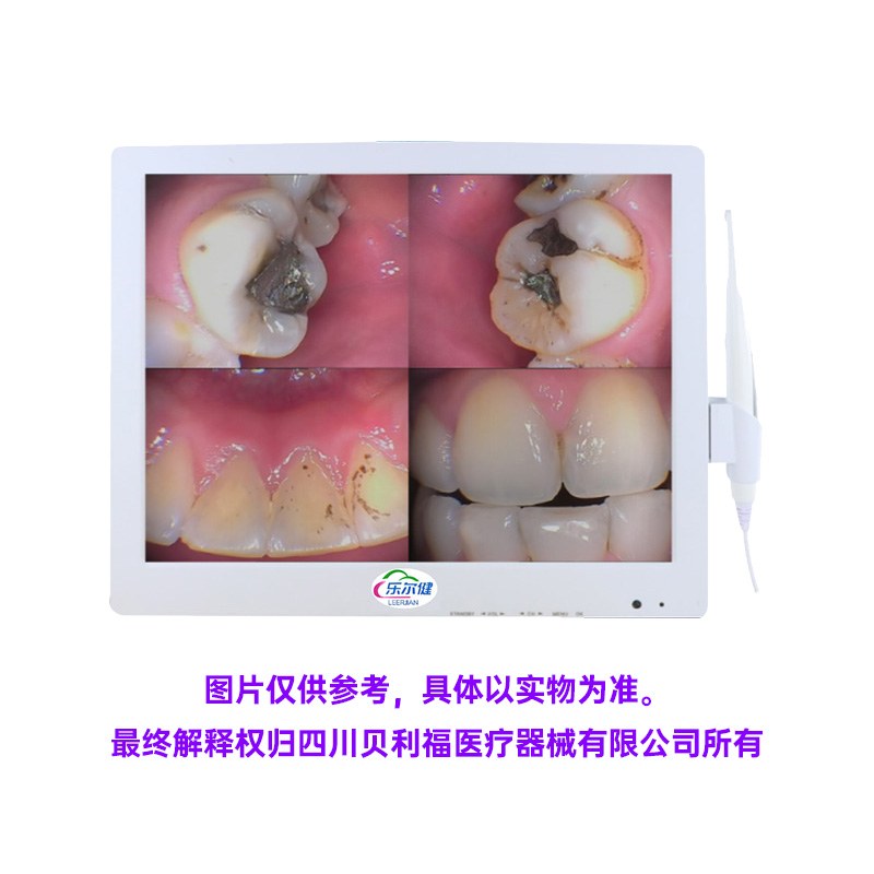 Oral Digital Observation Device